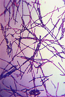 A photomicrograph of Bacillus anthracis bacteria using Gram stain technique