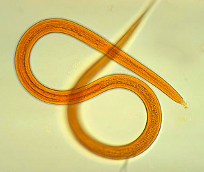 Strongyloides filariform larva